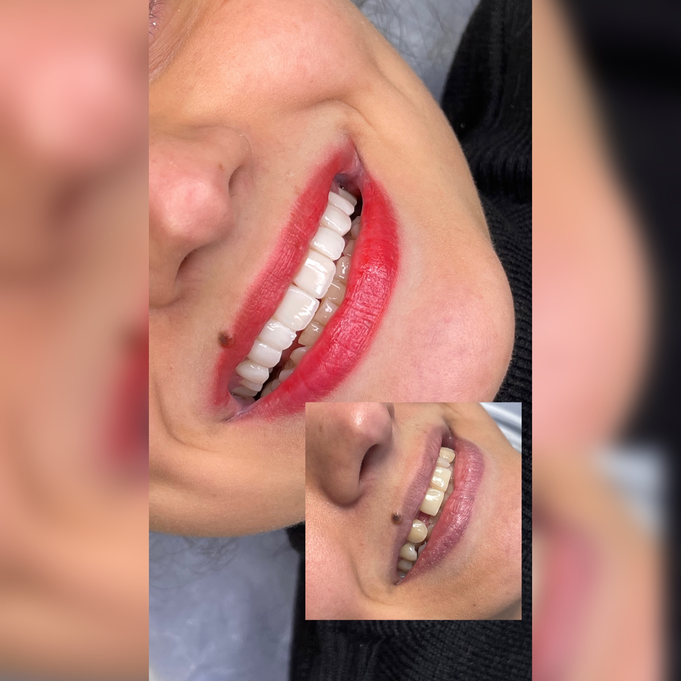 بعد
